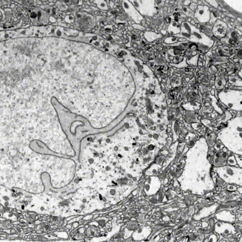 Bản sao bộ não lợn do Nectome thực hiện.